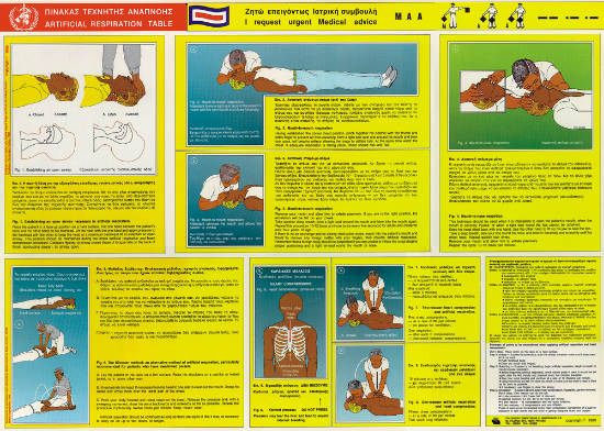 Picture of Artificial Respiration Table 45x67